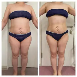 超音波、キャビテーション、EMSを使って美ボディに＊痩身エステ＊脚orお腹、1パーツコース