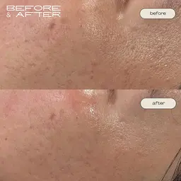 フェイシャルワックス