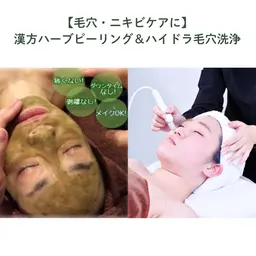 剥離無し🌿漢方ハーブピーリング+ハイドラ毛穴洗浄コース¥11000【初回¥8800】