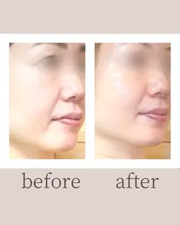 【モニター】〈透明感・ツヤ不足に〉蓄積汚れオフ×代謝を整え、内側から明るい艶肌