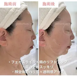 卒業式・入学式前限定🌸写真に残る“ママのためのリフトアップケア”