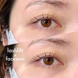 お肌つるつるっ✨フェイシャルワックス脱毛🧡