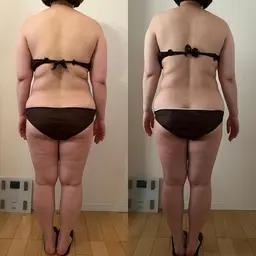 筋膜リリース＆セルライト対策