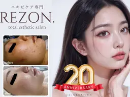 人気NO.1✨《脱ニキビ肌！》社会人🈹本気のニキビケア2回体験　※毛穴ディープクレンジング付　[大阪城北詰/京橋駅]