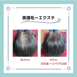 🌈増毛エクステ🌈薄い生え際、薄毛、白髪隠しのトップに🥰ファイバー毛を地毛一本に2〜4本結びつけます💕お試200本