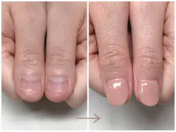 【ハンド深爪の方限定】再発させない深爪矯正お試し1回 ワンカラー仕上げ