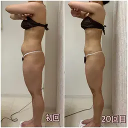 【本気痩せ希望の方◎】全身90分×２回¥9,900脂肪・セル撃退/骨格＆姿勢矯正