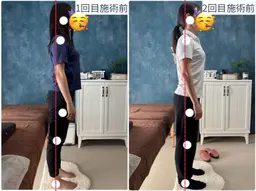 🎍新春クーポン🎍整体鍼🪡で年始のだるさ撃退！年初めを快適に過ごせるようになる！背筋ピーン☀️肩こりや腰痛にも◎