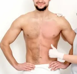 口コミ高評価🏅メンズ限定🔹最新脱毛機で全身脱毛(ヒゲ・VIO込み)