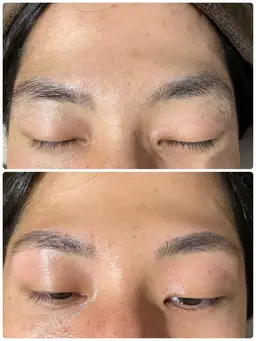🎊ミニモ限定🎊アイブロウWax脱毛🙈⭐️メンズに大人気ワックス脱毛🐥