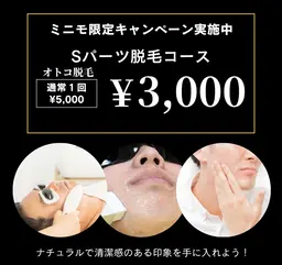 ヒゲ🥸脱毛したい‼️男性必見👀‼️初めてでも安心♪フェイシャル脱毛💆Sパーツ脱毛1回¥3,000