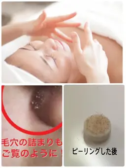 【人気メニューNo.1】🔱毛穴黒ずみ🔷角質ケア🔶ピーリング🈵