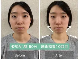 【新生活応援キャンペーン！】猫背&小顔歪み・左右差調整