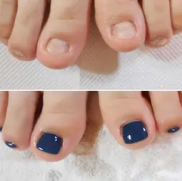 🦶【むしり癖・でこぼこ爪】🌿フット深爪矯正《ケア＋長さ出し＋ワンカラー仕上げ》
