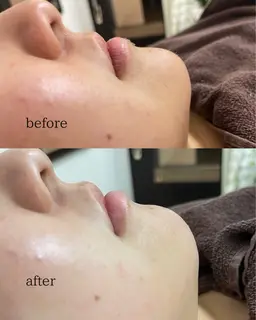 【ミニモ限定】クレンジングマッサージ+お顔剃り＋ヘッドスパ10分＋プラセンタパック付き♪