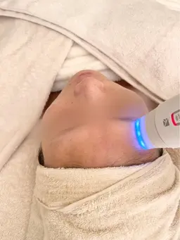 輝く白玉水光肌へ✨乳酸ピーリング✨美肌育成フェイシャル