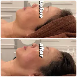 【本日限定🌟小顔コルギ】むくみスッキリ&フェイスライン改善✨