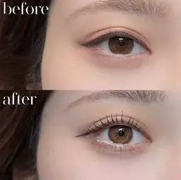 アップワードリフト　上下