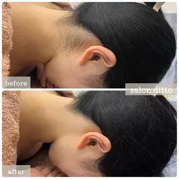 minimo限定＊うなじ脱毛