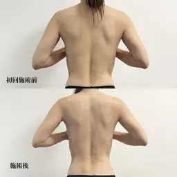 【慢性的な肩こり】骨格から変わる姿勢改善x首肩こりリセット150分コース ¥16,500