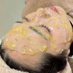 【ミニモ限定価格★ニキビ/跡】針を使わない美容液導入☆赤み鎮静ケア