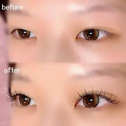 フラットラッシュ 100本