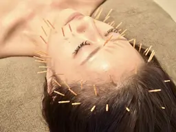 【新規】【選べる】美顔鍼フェイシャル+ヒト幹orプラセンタ 50分¥15400→¥6990