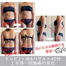 【下半身or上半身モニター】キャビ&EMS＋むくみ撃退バザルトで美脚へ！