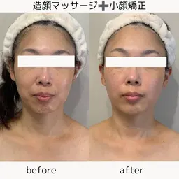 ☀︎北千住サロン限定☀︎人気の高いRico式スッキリ小顔矯正9０分