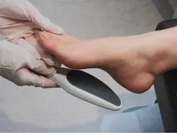 フット角質ケア🦶🏼🫧サンダルの季節に向け、足裏の角質を取りツルツルな足裏を手に入れましょう✨