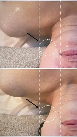 浮腫みたるみ撃退！！【小顔フェイシャル＋ドライヘッドスパ＋デコルテ首肩オイルマッサージ 】 110分