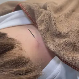 ㊗️🎊4周年記念🎊㊗️ 肩凝り•腰痛解消コース 30分¥3300 【鍼ほぐし】