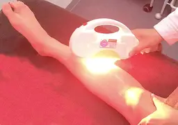 全身脱毛vio込み