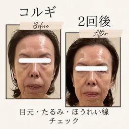 ご新規【コルギ＋骨盤調整＋美肌パック】