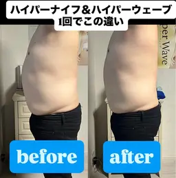 【お腹だけ出てきた方へ】腹部集中ハイパーナイフ60分