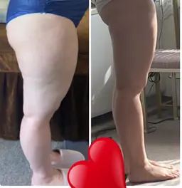 ミニモ限定🔥スピード痩身🔥美容整体付き！本気で痩身したい方に😊❤️限定3名様😋💪通い放題プラン🔥