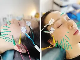 【日時指定】EMS美容鍼モニター&整体モニター同時募集ー内容をよくご確認の上、リクエストをお願いしますー