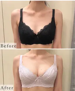 【モニター】お写真提供での特別価格♪  バストケアトリートメント[90分]＋腸もみ[15分]