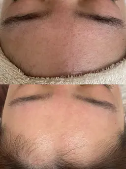 オプション●各パーツのみWax脱毛!他のメニューと組み合わせ(口周りのみ、鼻のみ、おでこのみ等)