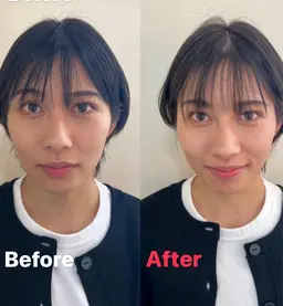 ミニモ限定！　クイックリフトアップ(10分) (施術者あり)リフトアップと小顔効果が期待できます🙆‍♂️