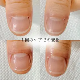 【ピンクの部分を伸ばす自爪育成ケア】お試し１回カウンセリング付♪