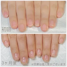 【最強のネイルケア】3ヶ月8回自爪育成コース ✨深爪矯正・自爪育成・爪トラブル✨縦長の美爪に育成✨オフィスネイル◎