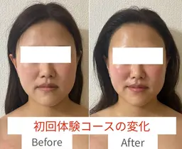 初回体験価格！トライアングルフェイシャル®️