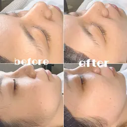 美眉スタイリング（眉毛ワックス）＋艶肌フェイスワックス（全顔）