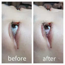 ラスティングカール 下