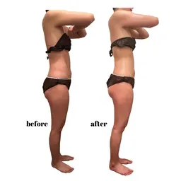 🍔本気で痩せたい人に🍔最新機器『セルライトゼロ』