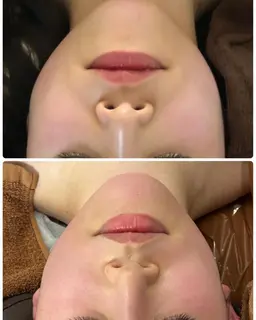 小顔整体💆‍♀️✨フェイスライン・エラ・頬骨・小鼻ほうれい線・毛穴・美白お試し♪小顔マッサージ、ヘッドマッサージ付き