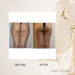 ヒップアップコース