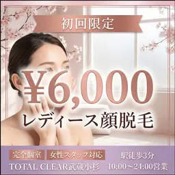 303号室】《女性限定》お顔全体の脱毛が6,000円♪産毛もしっかり抜ける♪