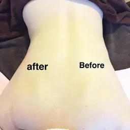 オールハンド調律エステ40分